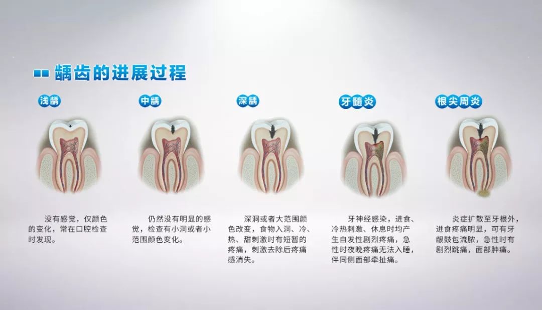 龋齿的形成过程图片图片