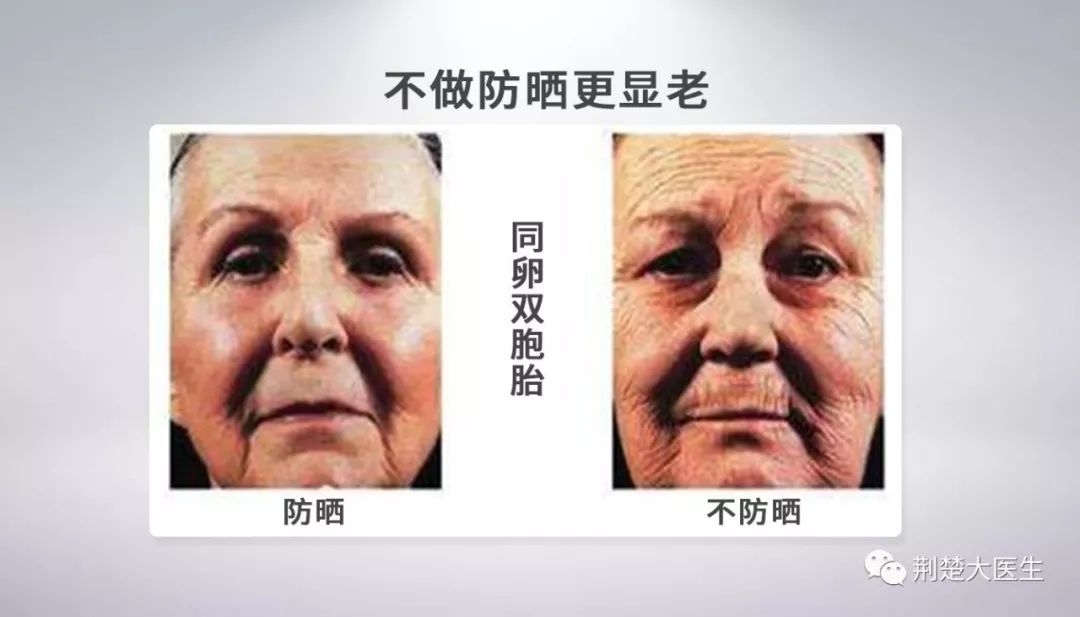 光老化对皮肤的影响图片