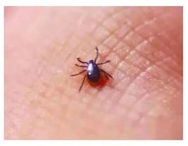 男子发烧胸闷还出现大白肺多科会诊发现元凶竟是它