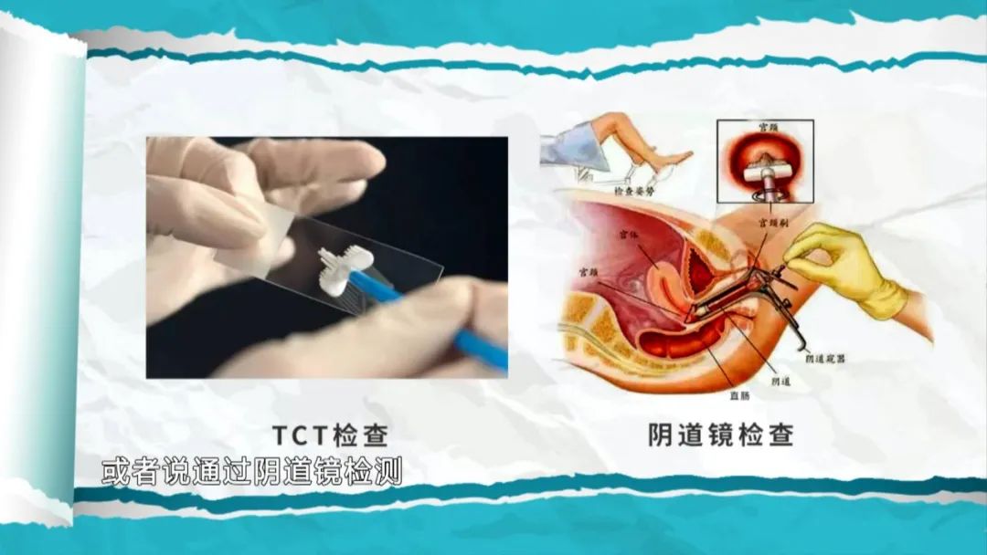 关于hpv的五个误区你知道吗