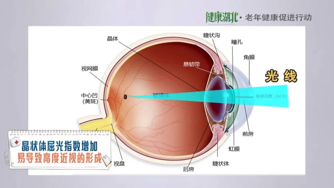 眼睛真的能返老还童吗?