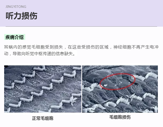 没有耳镜怎么使用手机音量超标会造成听力损伤！很多人都没注意_https://www.jmylbn.com_新闻资讯_第1张