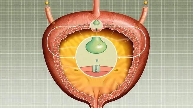 膀胱充盈图片图片