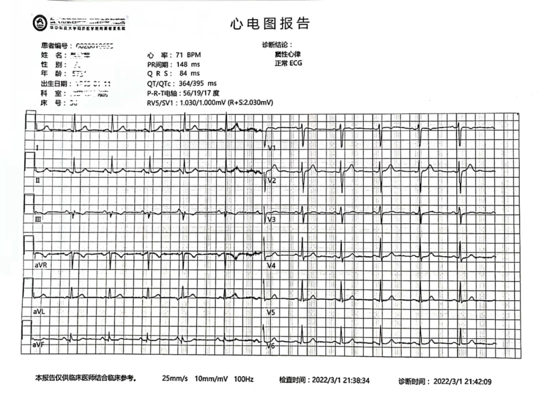 心律不齐报告单图片