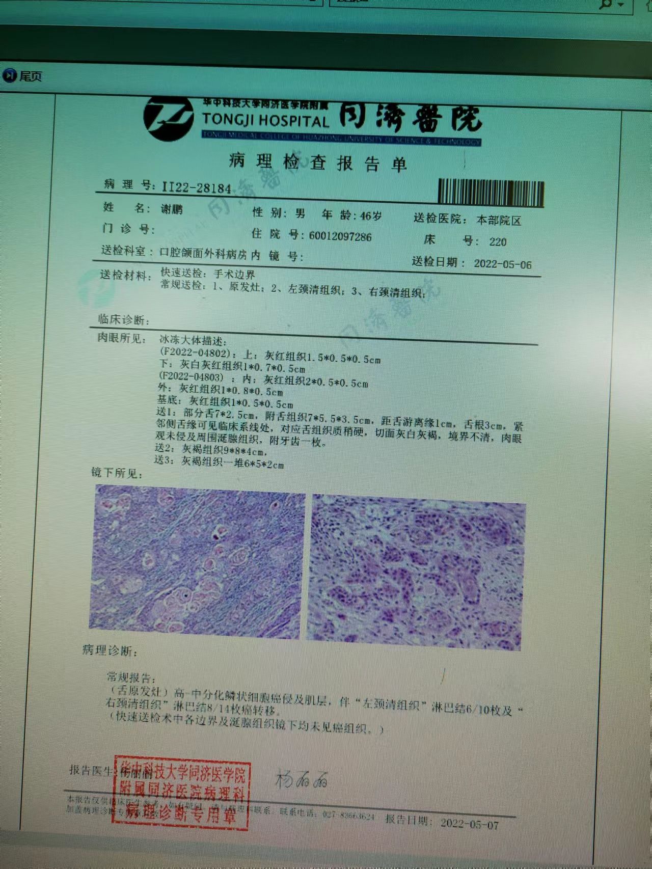 万万没想到这一痛又是癌症