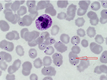 寄生于人体的疟原虫主要有4种,即间日疟原虫,恶性疟原虫,三日疟原虫和