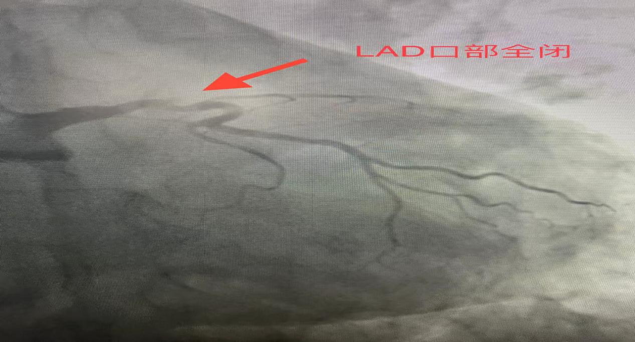 a034983cbafc74e2a2533070ee68ccd