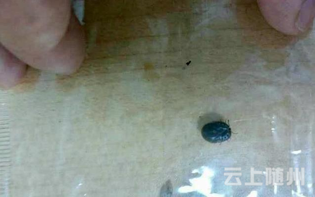 男子散步回来身上多个黑点 从腿上拉出活蜱虫