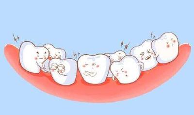 使用牙线清洁牙齿会使牙缝变大吗？
