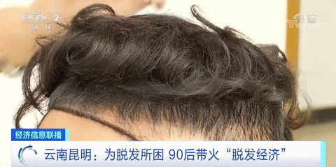 挺“秃”然的！植发群体超半数为90后