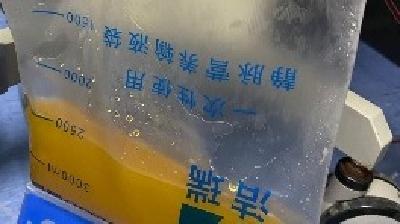  男子血液里竟滤出黄“油” 真相是高胆固醇血症进一步恶化