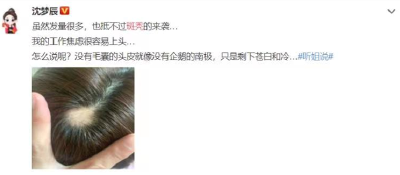 沈梦辰突然斑秃上热搜！传说中的