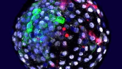 重磅！科学家造出首个“人-猴胚胎”