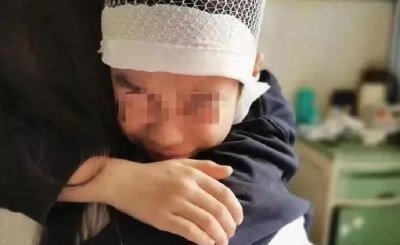 男童头皮骨分离，对教师“重手”应重罚