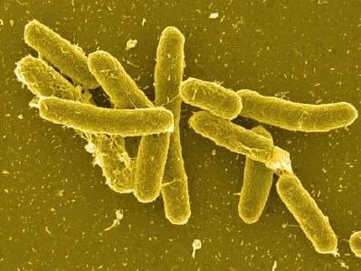 美国29个州暴发沙门氏菌疫情，感染近280人