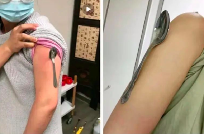 “小红书”上有人打疫苗后胳膊能吸铁勺？辟谣！