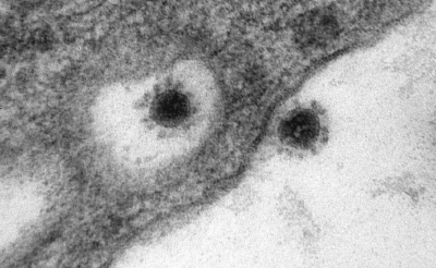 “德尔塔”新冠变异毒株长啥样？俄罗斯一病毒研究所公布最新照片