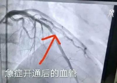 警惕！国庆假期，千万别做这5件“傻事”，小心大病找上你！几乎每年都会有…