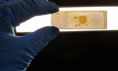 澳大利亚研发新型显微镜载玻片快速识别癌细胞