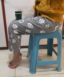 膝盖的“保鲜期”只有30年？出现这5种症状，小心膝盖“早衰”！一个动作延缓衰老