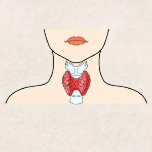 脖子、胸部有肿块？先别纠