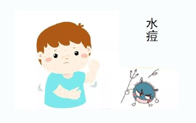 战胜这“幽灵”，赐予我力量吧！ ——带状疱疹疫苗解说与问答