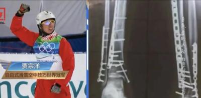 冬奥赛场最佳气氛组——赛场DJ：哪一首BGM让你瞬间嗨起来？