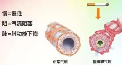 这个“沉默”杀手，杀人于“无形”！