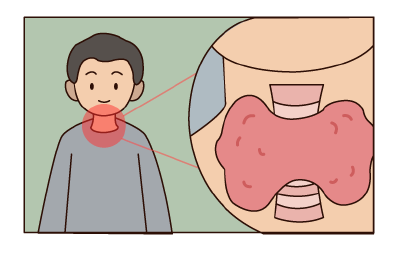 体检时，这个动作很重要……
