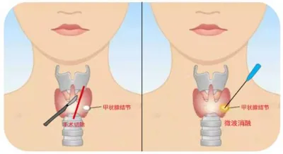 体检时，这个动作很重要……