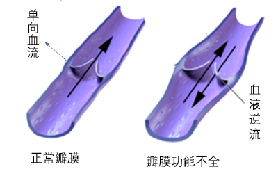 你有“蚯蚓腿”吗？不能再拖了！