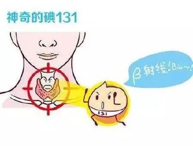 甲亢治疗那“碘”事儿