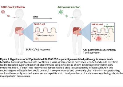 不明原因儿童急性肝炎最新发现：或与新冠病毒超级抗原相关