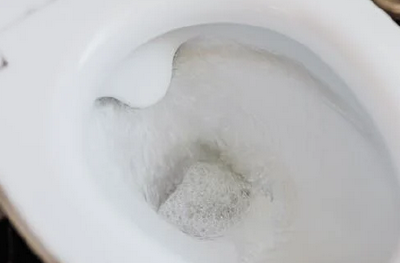 大便异常暗示着健康出现了问题？带你揭秘这5种大便异常的真相！