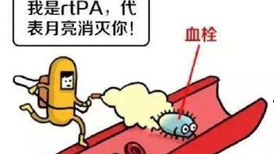 脑血管堵塞怎么办？这些方法能救命！