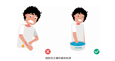遭遇烫伤、烧伤，我们到底应该怎么办？