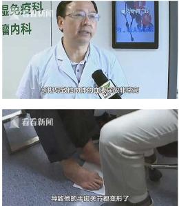轻则生病，重则没命！天气再热也不能这么吃！