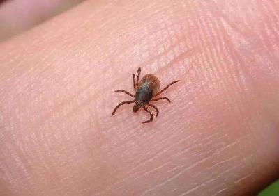 夏季警惕蜱虫 记住这几招避免蜱虫叮咬