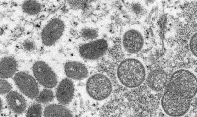 世卫：27个非猴痘流行国家和地区报告780例猴痘病例