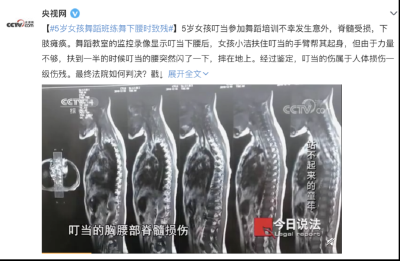 1个危险动作，让5岁娃高位截瘫！成年人也要当心！