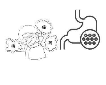 女子陪丈夫复查，却查出早期胃癌？