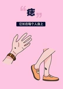 医生，我这到底是痣还是瘤？