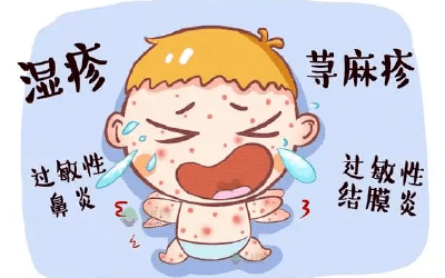 孩子生病总不好，当心过敏惹得祸！