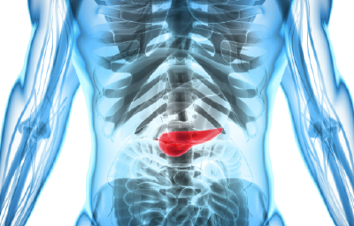 这些人群注意了！这个“癌中之王”很容易被忽视！