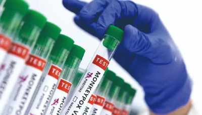 全美已有超1.4万例猴痘病例 纽约州报告首例未成年病例