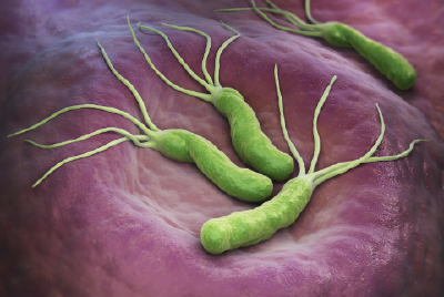 “明确致癌物”幽门螺杆菌，究竟该怎么防？