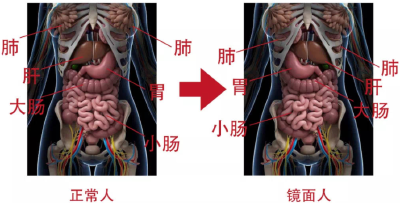 一女子五脏六腑全部反着长！医生：一旦患病影响手术治疗