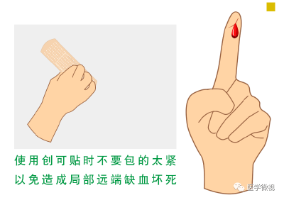 用什么给伤口消毒最好？创可贴的使用原来也大有名堂！