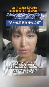 李子柒称割漆回家脸肿成“电视机” 整个团队去医院打抗敏针