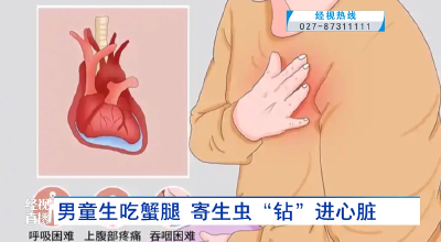 男童生吃蟹腿 寄生虫“钻”进心脏